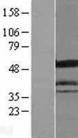 ICA69 / ICA1 Protein (Over-Expression Lysate Myc-DDK (Flag))
