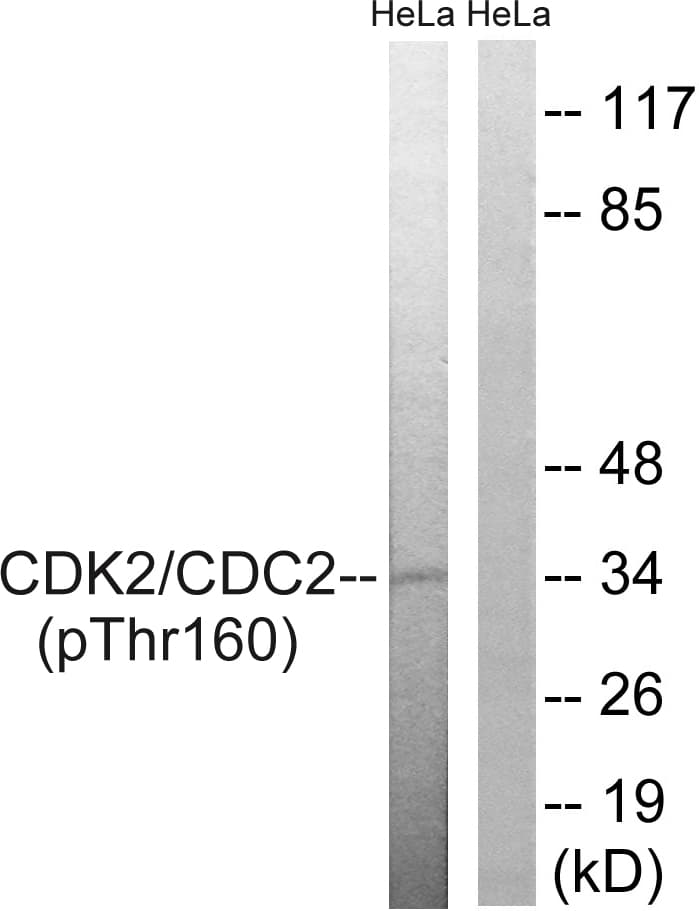 Polyclonal Rabbit anti-Human CDK1 / CDC2 Antibody (phospho-Thr161, IHC, WB)
