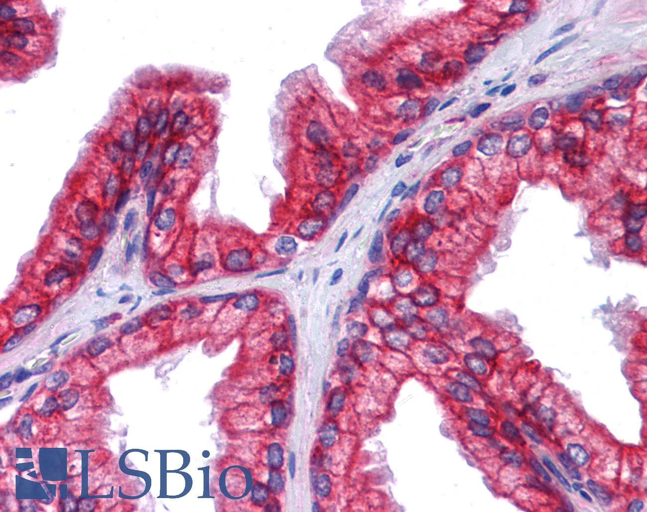IHC-plus™ KRT8 / CK8 / Cytokeratin 8 Antibody (clone 8A5D12)