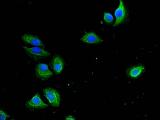 Polyclonal Rabbit anti-Human PRMT1 Antibody (IF)