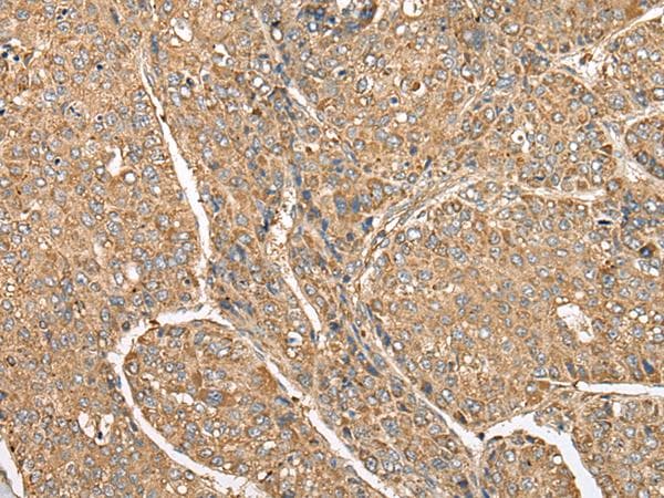 Polyclonal Rabbit anti-Human C5AR1 / CD88 / C5a Receptor Antibody (IHC)
