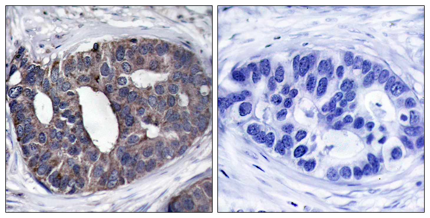 Polyclonal Rabbit anti-Human DOK1 Antibody (aa329-378, IHC, WB)