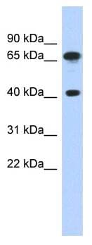 Polyclonal Rabbit anti-Human FUBP3 Antibody (aa503-552, IHC, WB)