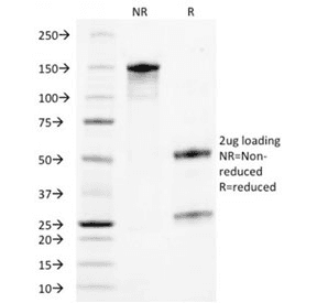 TROP2 / TACSTD2 Antibody (clone TACSTD2/2153)