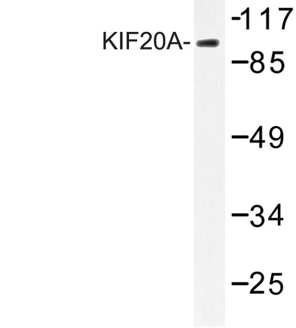 RAB6KIFL / KIF20A Antibody (Ile524)