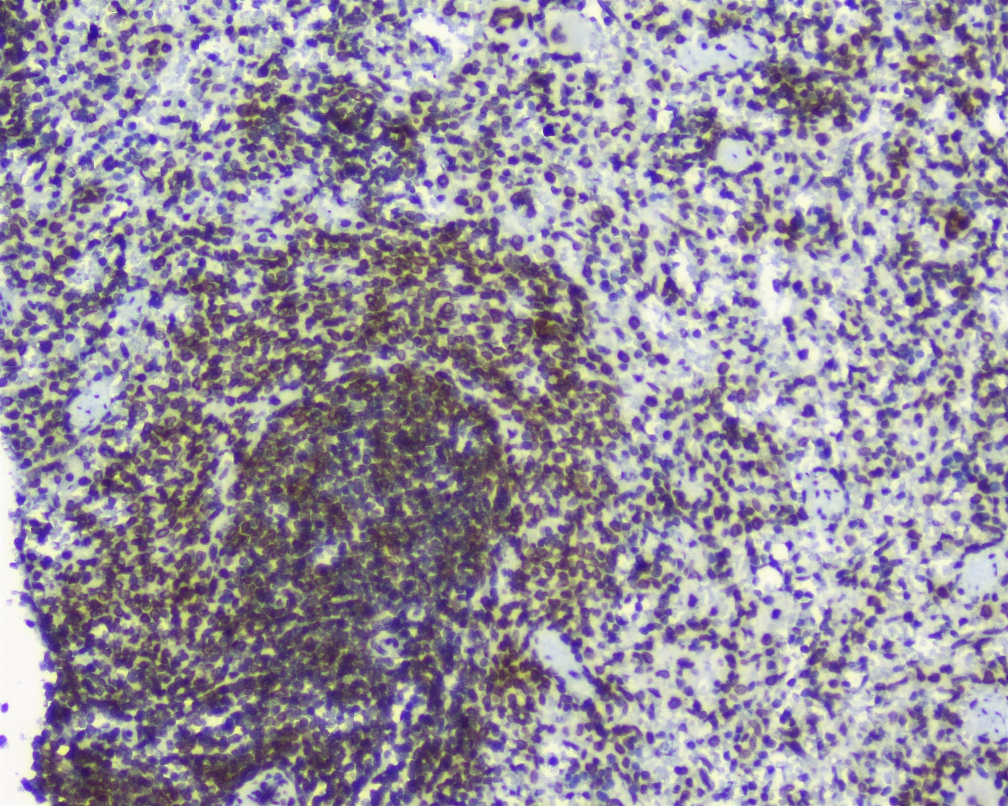 TPR Antibody