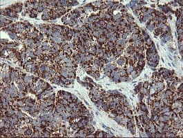 Monoclonal Mouse anti-Human GBAS Antibody (clone 1B8, Carrier-free, IHC, IF, WB)