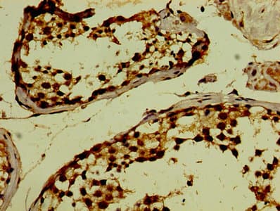 PHF6 Antibody (aa2-312)