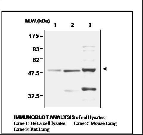 IHC-plus™ FDXR Antibody