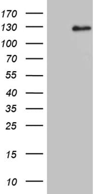 Monoclonal Mouse anti-Human DACT1 / DAPPER Antibody (clone OTI10F12, Carrier-free, aa289-555, WB)