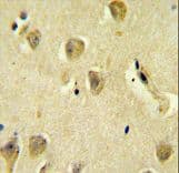 Polyclonal Rabbit anti-Human PPP1R14C / KEPI Antibody (aa126-155, IHC, WB)