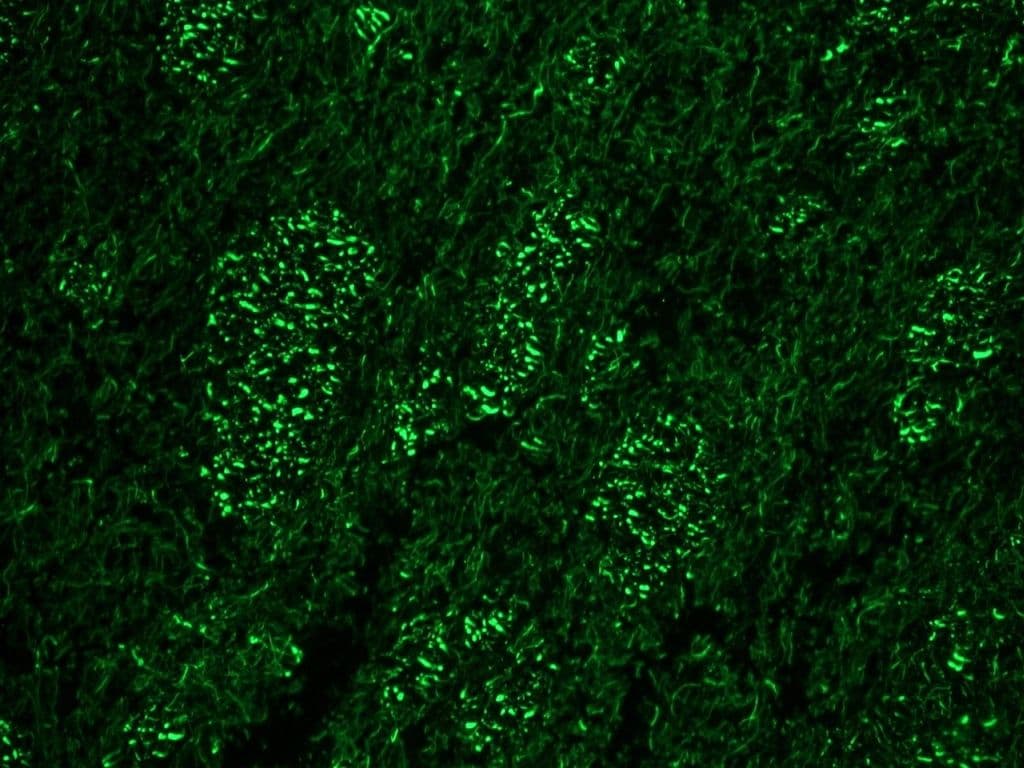 IHC-plus™ Monoclonal Mouse anti-Human NEFH / NF-H Antibody (clone RNF404, IHC, WB)