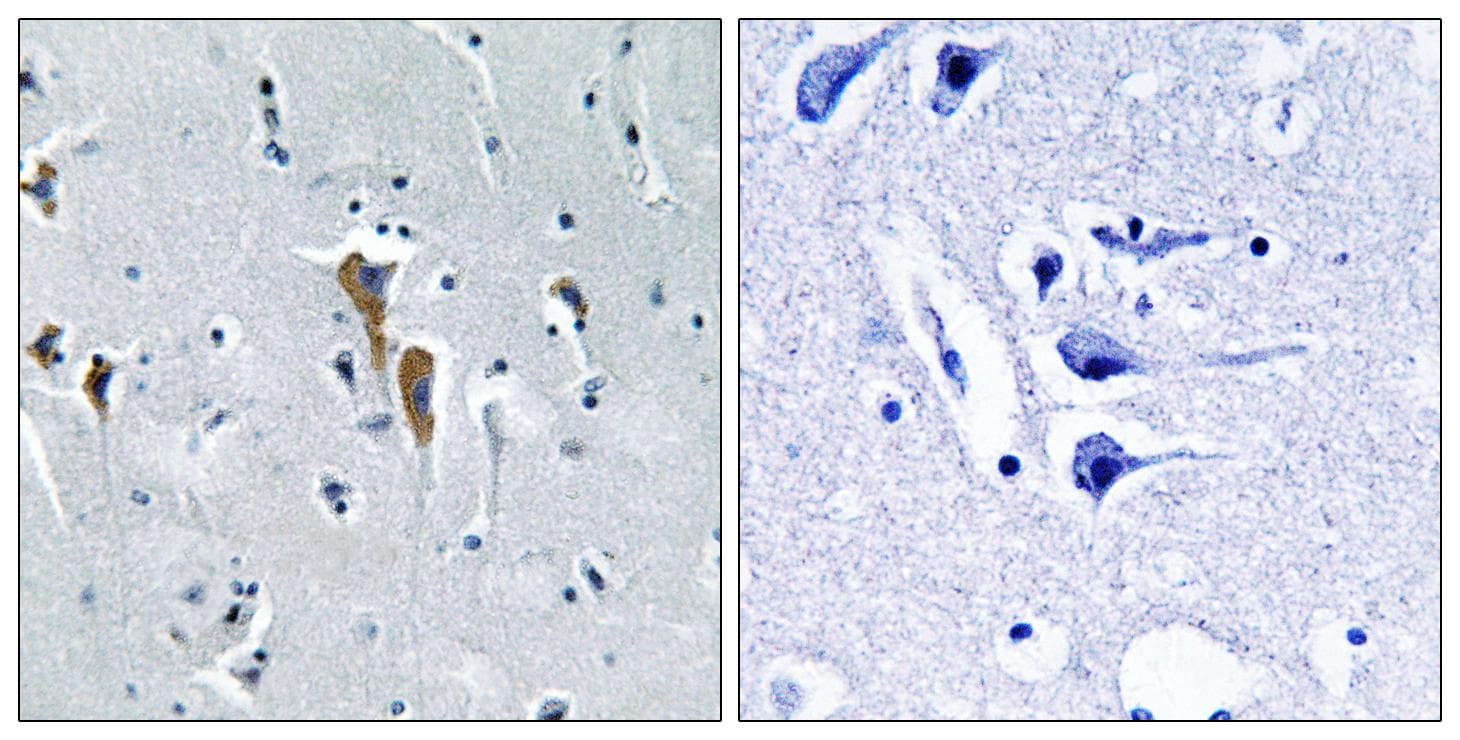 LIPC / Hepatic Lipase Antibody