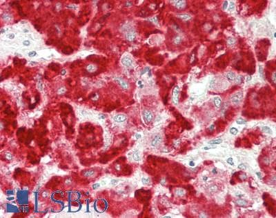 IHC-plus™ AKAP5 / AKAP79 Antibody (N-Terminus)