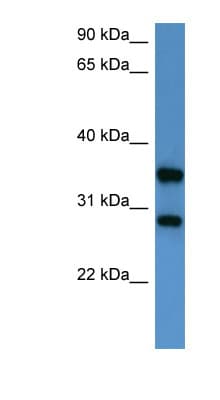STYXL1 Antibody (aa140-189)