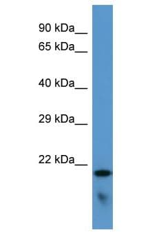 Polyclonal Rabbit anti-Human FAM57B Antibody (aa163-212, WB)