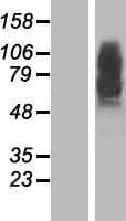 Human PSEN2 / Presenilin 2 Protein (Over-Expression Lysate Myc-DDK (Flag))