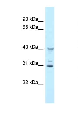 Oas1g Antibody (aa60-109)