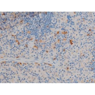 Polyclonal Rabbit anti-Human BCL2 / Bcl-2 Antibody (phospho-Ser70, IHC, IF, WB)