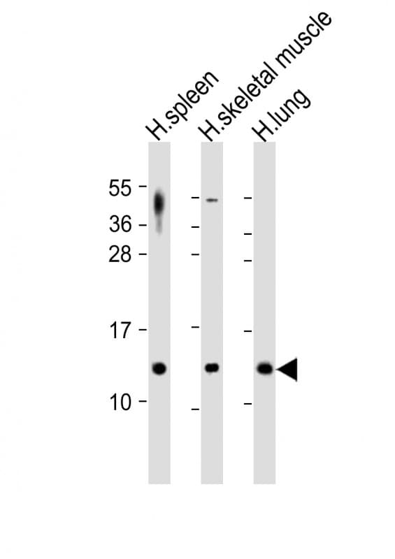 Polyclonal Rabbit anti-Human CCL17 / TARC Antibody (WB)
