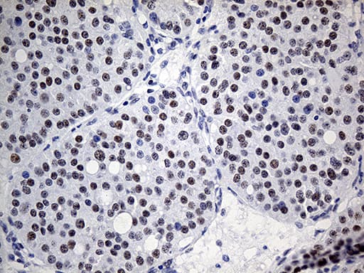 KDM3A / JMJD1A Antibody (aa850-1321, clone OTI5A7)