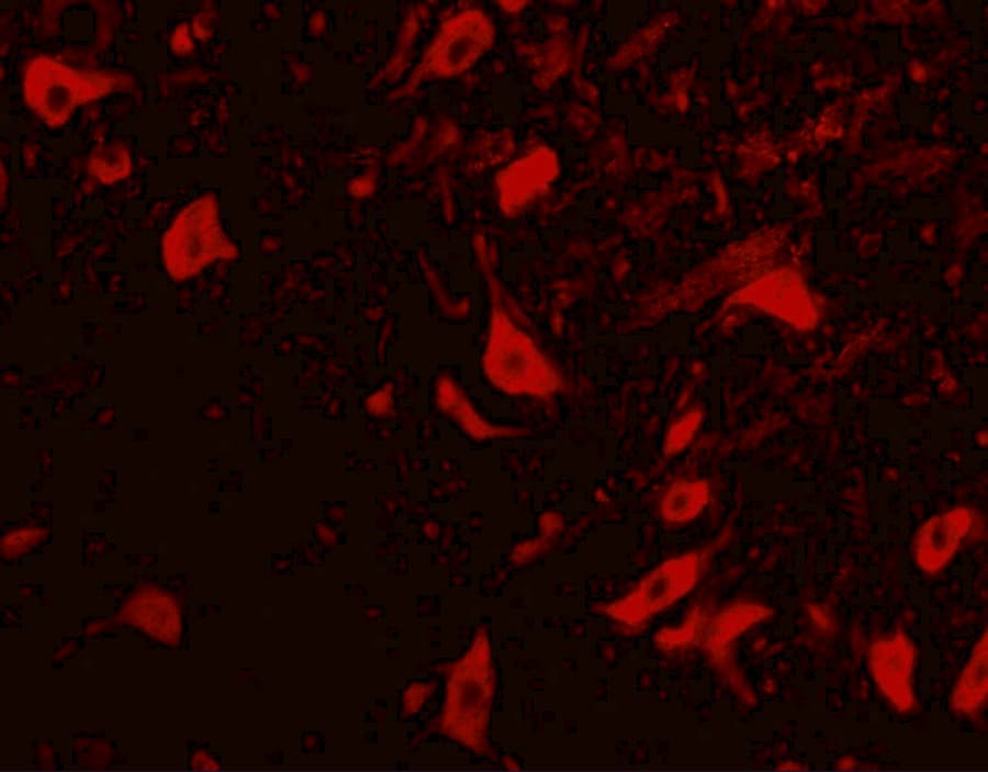 TRIM5 Antibody