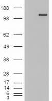 TRIM33 / TIF1-Gamma Antibody (clone OTI6B7)