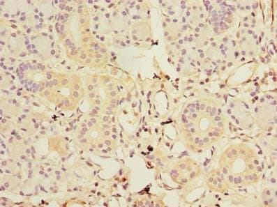 GDAP1L1 Antibody