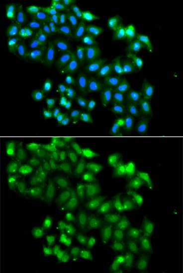 BCAP / PHF11 Antibody