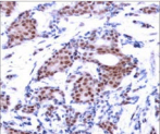 ELK1 Antibody