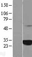C1orf216 Protein (Over-Expression Lysate Myc-DDK (Flag))