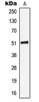 Polyclonal Rabbit anti-Human KRT16 / CK16 / Cytokeratin 16 Antibody (C-Terminus, IHC, IF, WB)