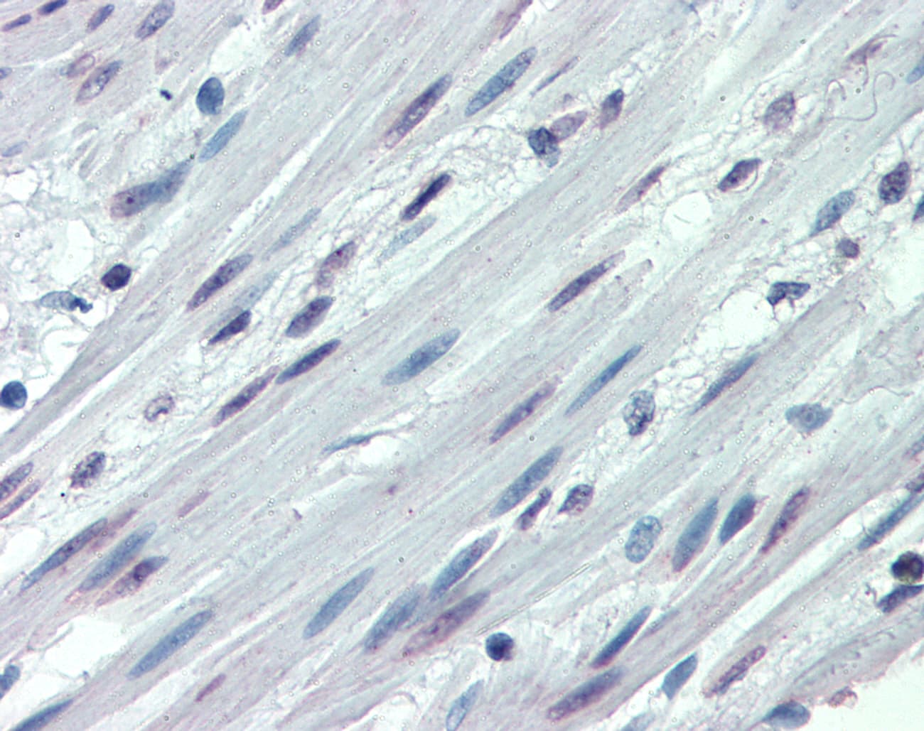 IHC-plus™ Polyclonal Rabbit anti-Human ITGA3 / CD49c Antibody (N-Terminus, IHC)