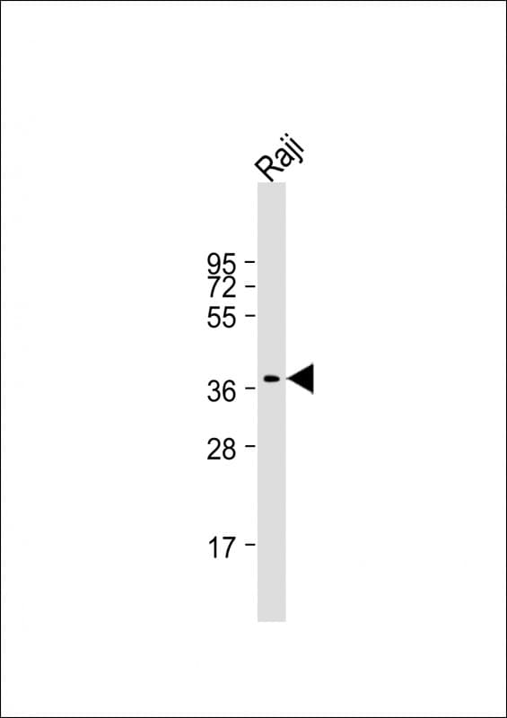 RASSF2 Antibody (aa1-326, clone 1509CT269.10.9.29)