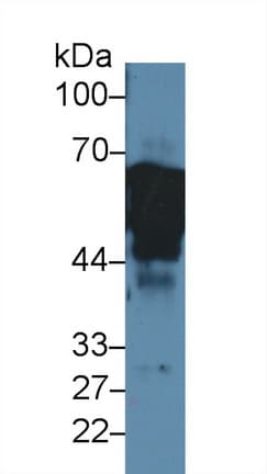 KRT8 / CK8 / Cytokeratin 8 Antibody (aa92-393, Biotin)