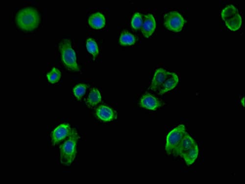 MX1 / MX Antibody