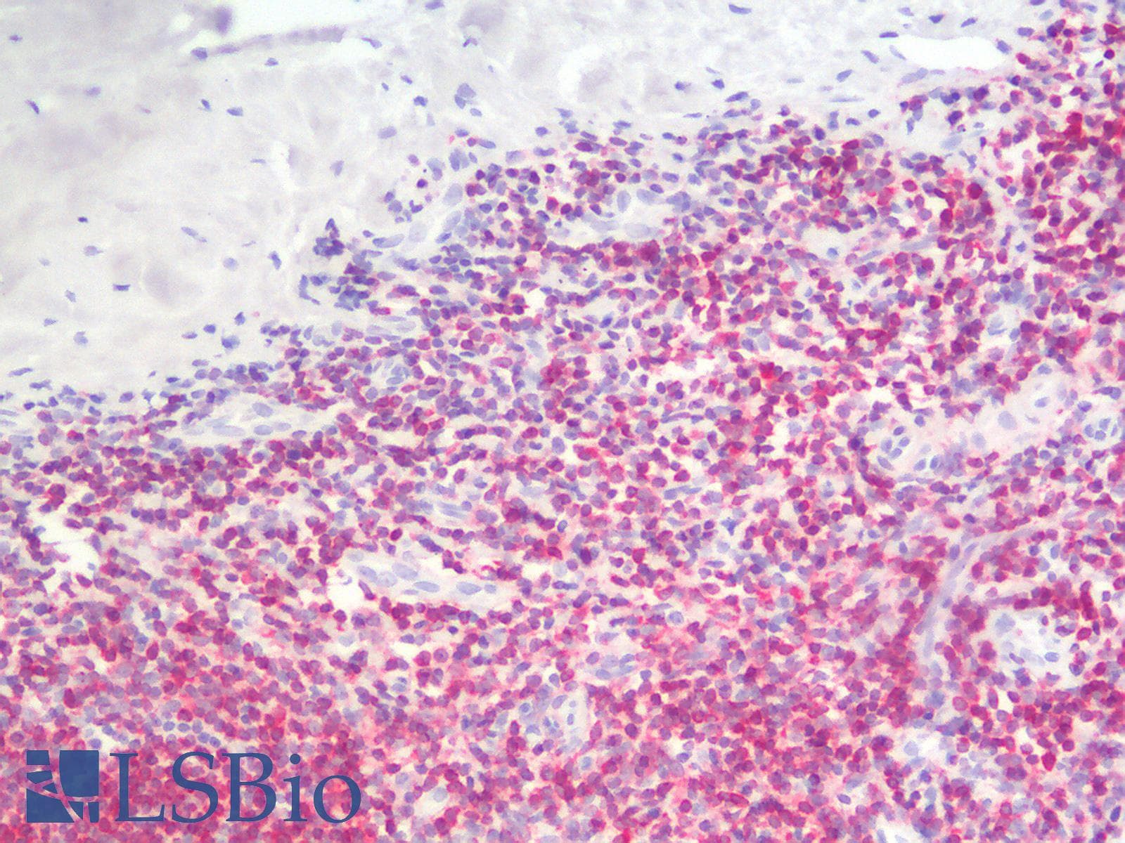 PathPlus™ BCL2 / Bcl-2 Antibody (clone BCL2/1878R)