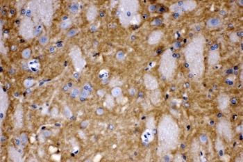 Polyclonal Rabbit anti-Human CD47 Antibody (IHC, IF, WB)