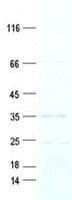 Human SKAP / HSD11 Protein (Recombinant Myc-DDK (Flag), C-terminus)