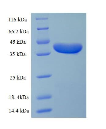 Human DSP / Desmoplakin Protein (Recombinant His-SUMO)