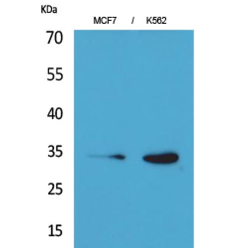CDK4 Antibody (1-50 aa, N-terminal)