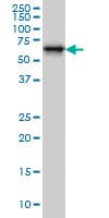 IHC-plus™ RTKN / Rhotekin Antibody (clone 2E5)