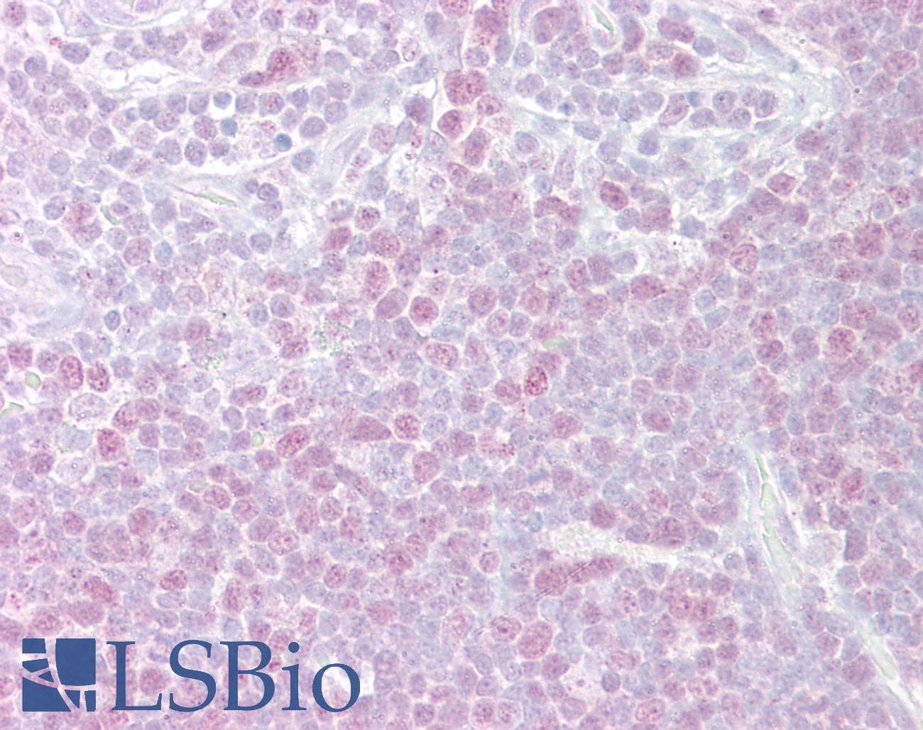 Polyclonal Rabbit anti-Human MCM3 Antibody (aa726-775, IHC, WB)