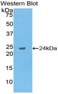 LAT2 / NTAL Antibody (aa30-209)