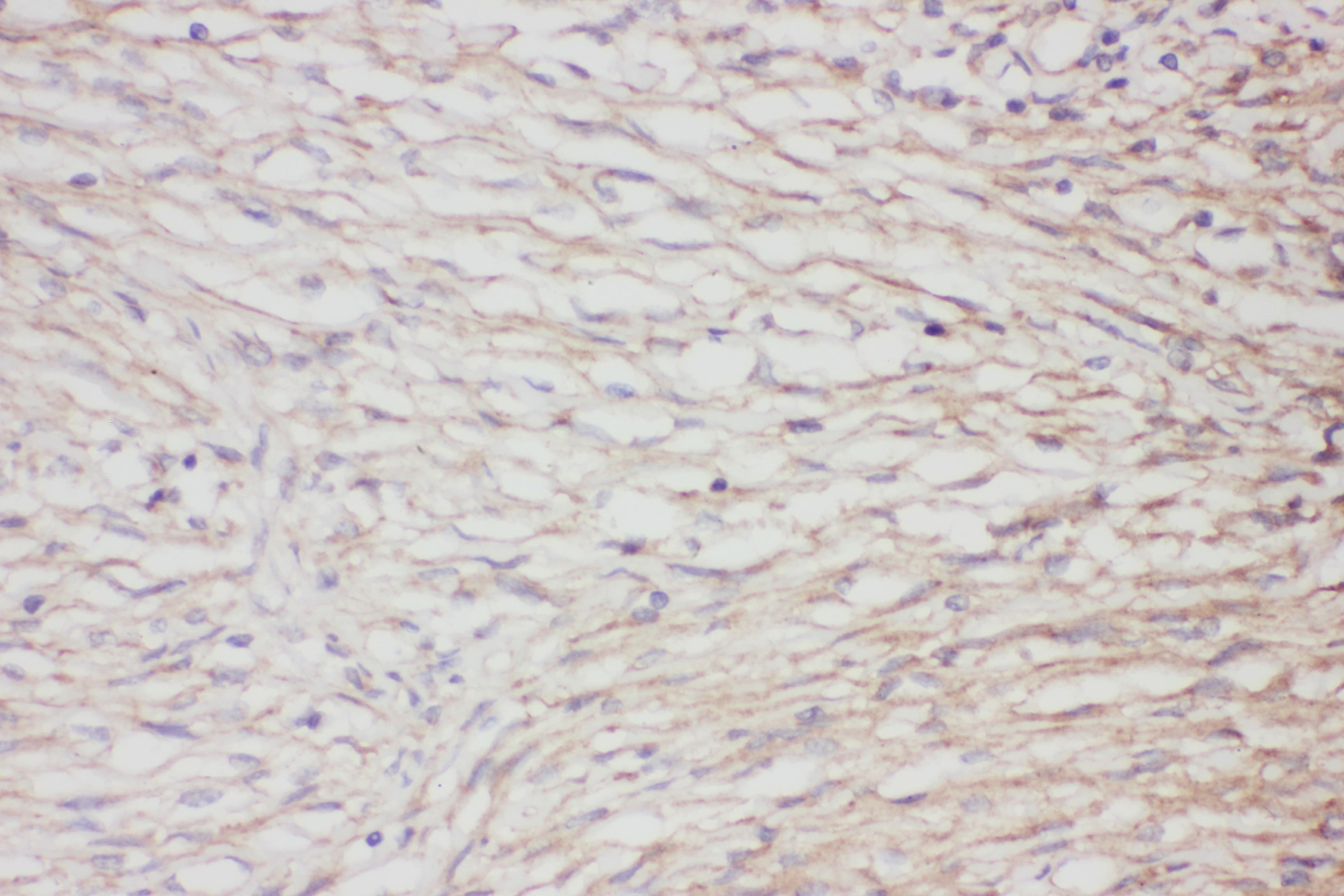 GFAP Antibody (aa93-432)