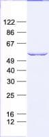 Human KRT6C / CK6C / Cytokeratin 6C Protein (Recombinant His, N-Terminal)