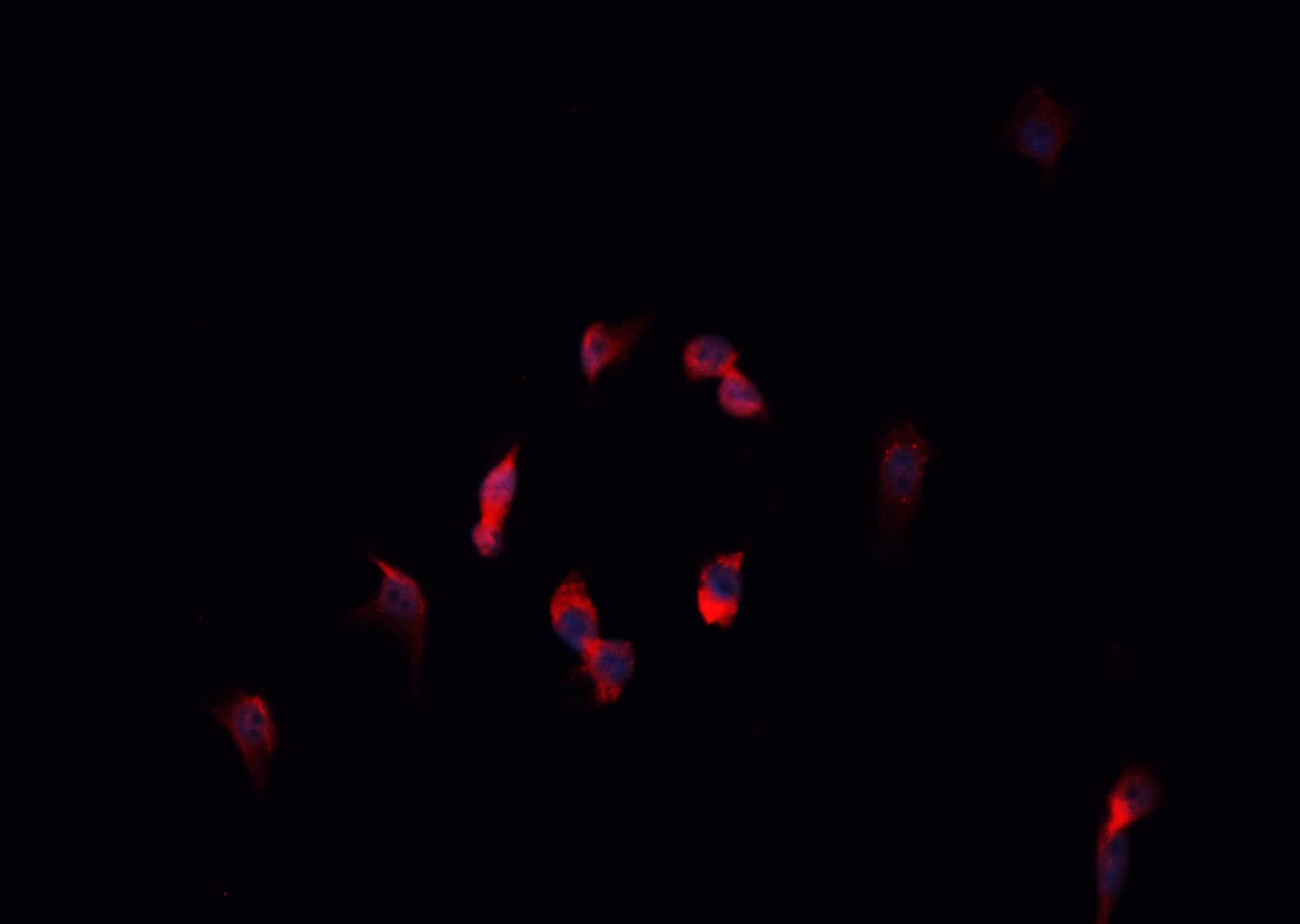 HNRPA1 / HnRNP A1 Antibody