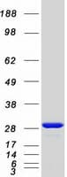 Human CALB1 / Calbindin Protein (Recombinant Myc-DDK (Flag))