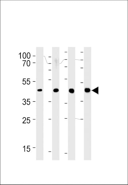 Polyclonal Rabbit anti-Human SRD5A2L / SRD5A3 Antibody (aa283-311, IHC, WB)