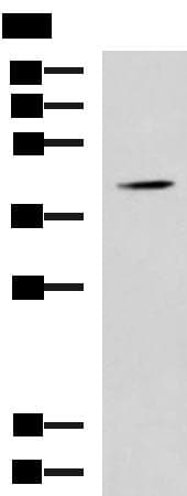 SPI1 / PU.1 Antibody
